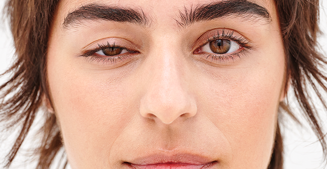 Queda da pálpebra pode ser causada por lentes de contato