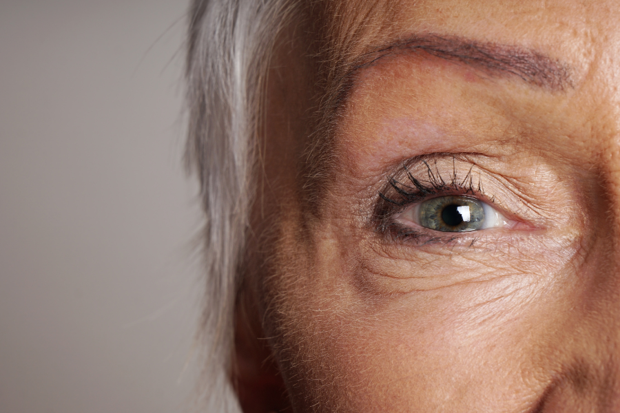 sinais de envelhecimento ao redor dos olhos