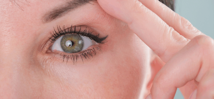 O que é ptose palpebral? Como funciona o tratamento