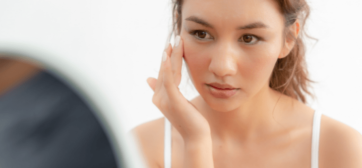 Blefarite tem relação com rosácea? Qual o tratamento?