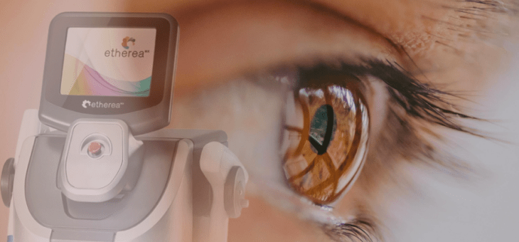 Luz Intensa Pulsada para Blefarite e Doenças Oculares – Como funciona