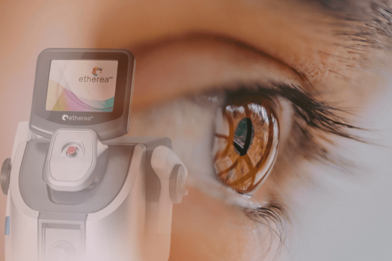 luz intensa pulsada para blefarite e doenças oculares