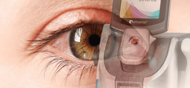 Cansado de tratar blefarite sem resultado? Conheça a luz intensa pulsada (IPL)