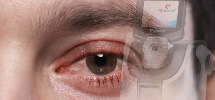 Será que a luz intensa pulsada para os olhos é para você?